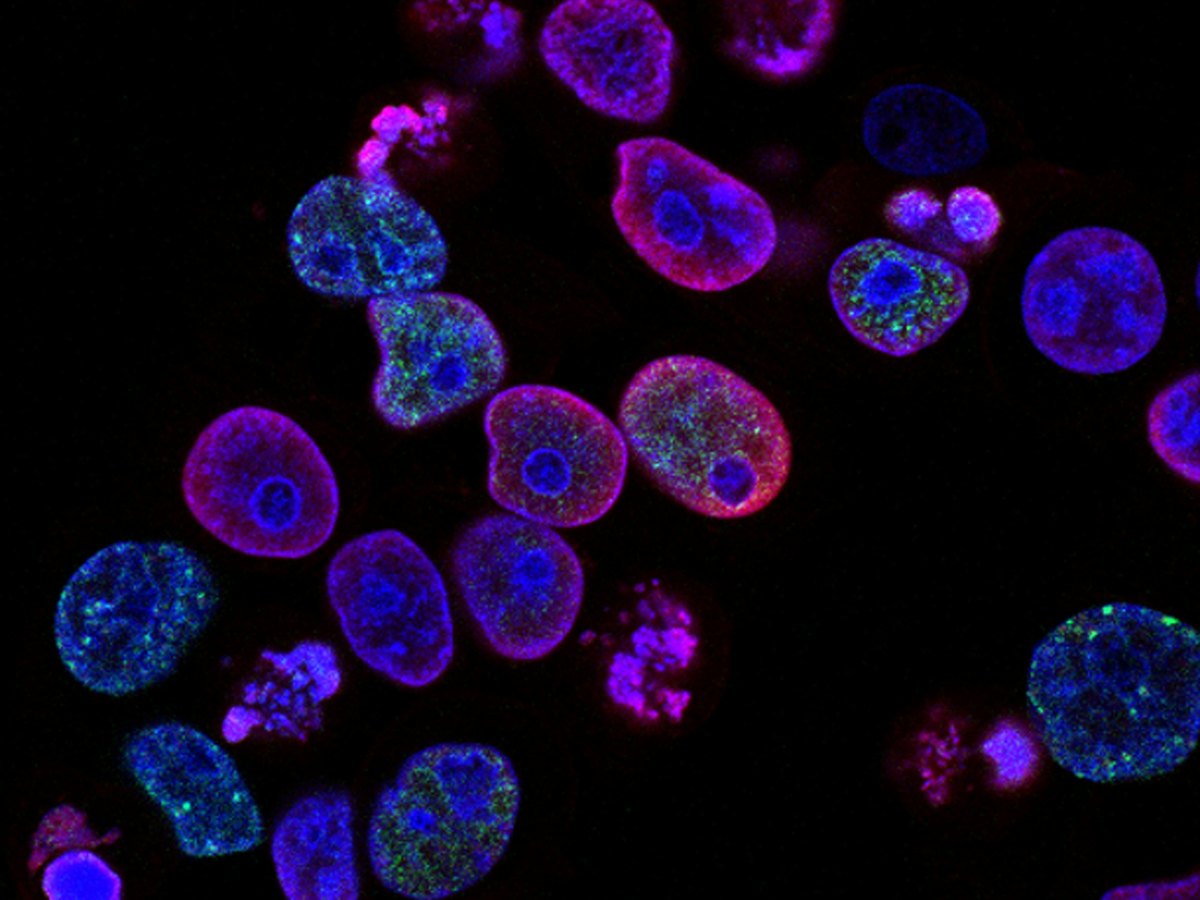 Fluorescence microscopy image showing brightly colored cells against a dark field.